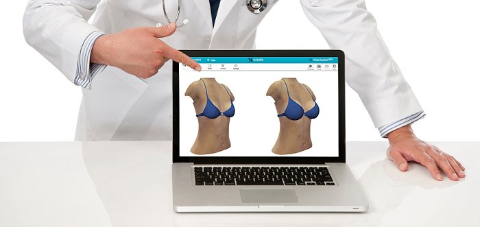 dr martin ulloa cirujano plastico software visualizacion 3D aumento de pechos
