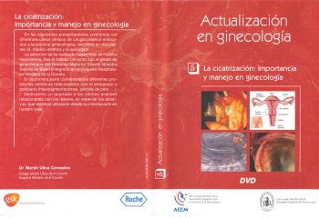 Dr. Martín Ulloa, Cirujano Plástico: Cicatrizacion importancia y manejo en ginecologia